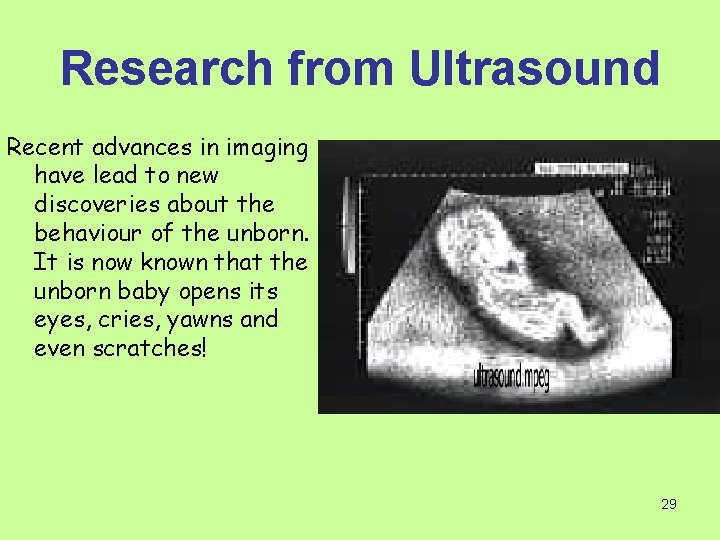 Research from Ultrasound Recent advances in imaging have lead to new discoveries about the