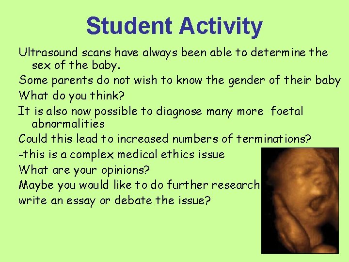 Student Activity Ultrasound scans have always been able to determine the sex of the