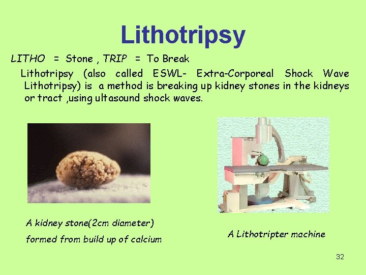 Lithotripsy LITHO = Stone , TRIP = To Break Lithotripsy (also called ESWL- Extra-Corporeal