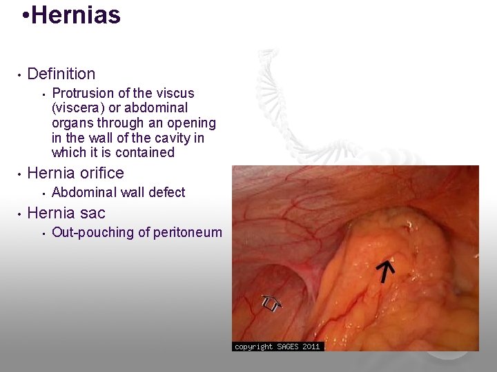  • Hernias • Definition • • Hernia orifice • • Protrusion of the