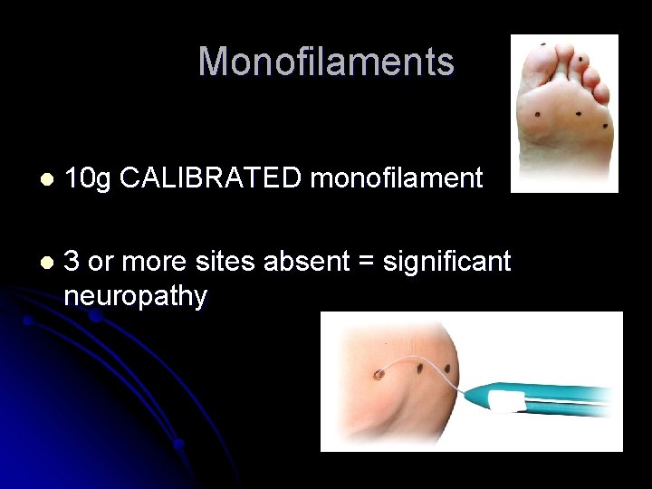 Monofilaments l 10 g CALIBRATED monofilament l 3 or more sites absent = significant