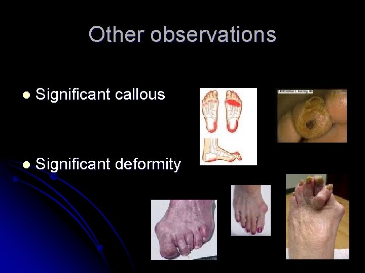 Other observations l Significant callous l Significant deformity 