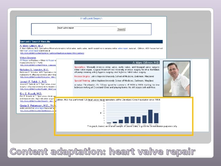 Content adaptation: heart valve repair 