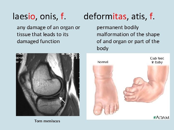 laesio, onis, f. any damage of an organ or tissue that leads to its