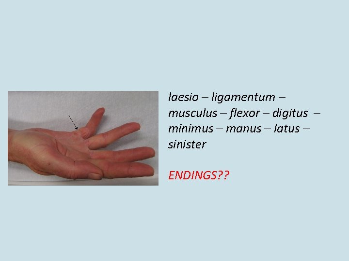 laesio – ligamentum – musculus – flexor – digitus – minimus – manus –