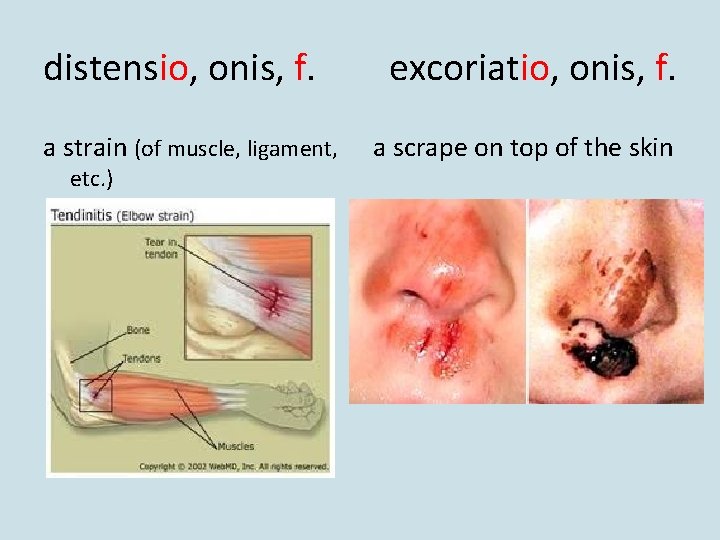 distensio, onis, f. a strain (of muscle, ligament, etc. ) excoriatio, onis, f. a