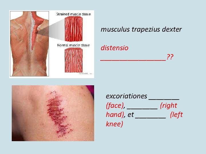 musculus trapezius dexter distensio _________? ? excoriationes ____ (face), ____ (right hand), et ____