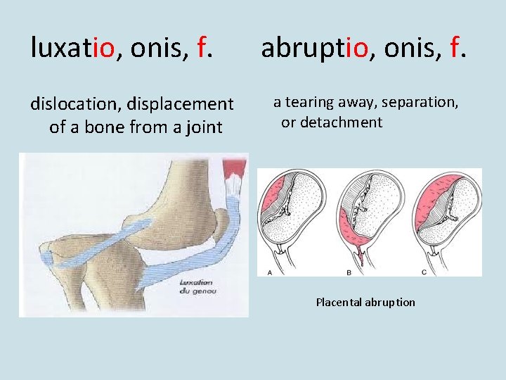 luxatio, onis, f. dislocation, displacement of a bone from a joint abruptio, onis, f.