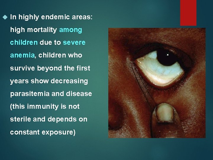  In highly endemic areas: high mortality among children due to severe anemia, children
