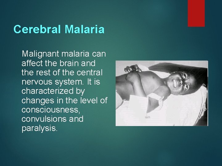 Cerebral Malaria Malignant malaria can affect the brain and the rest of the central