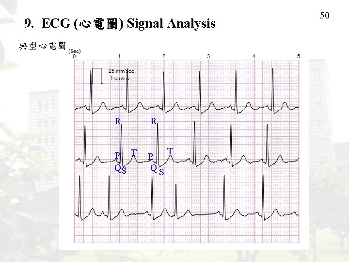 9. ECG (心電圖) Signal Analysis 典型心電圖 R R P T QS P QS T