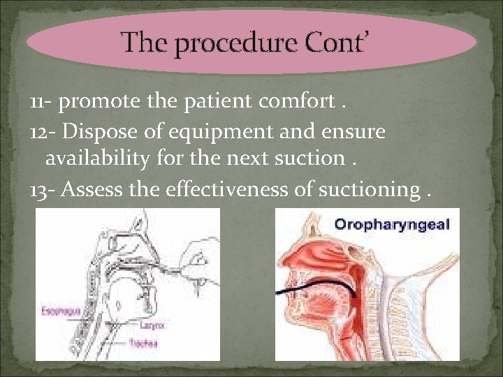 The procedure Cont’ 11 - promote the patient comfort. 12 - Dispose of equipment