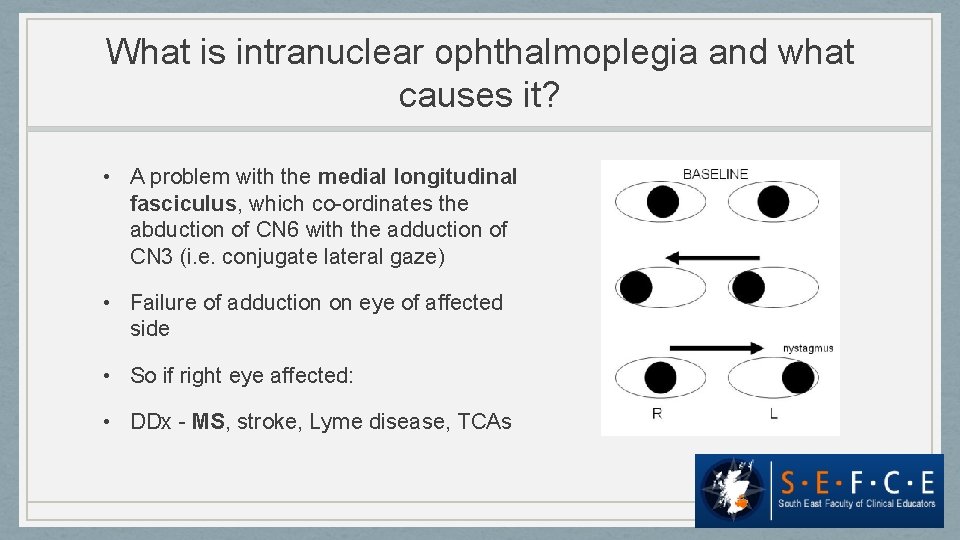 What is intranuclear ophthalmoplegia and what causes it? • A problem with the medial