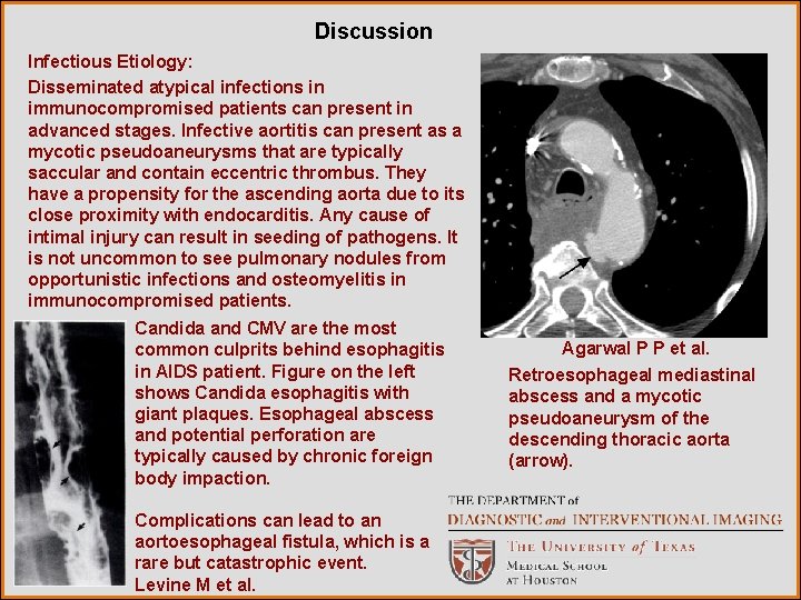 Discussion Infectious Etiology: Disseminated atypical infections in immunocompromised patients can present in advanced stages.