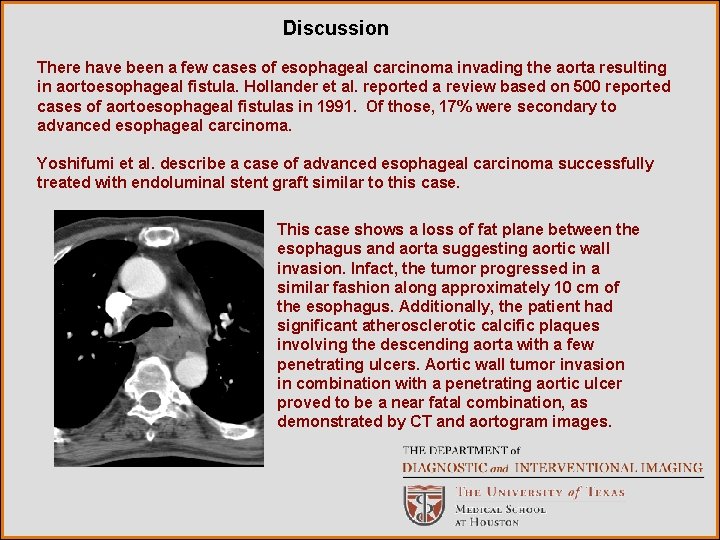 Discussion There have been a few cases of esophageal carcinoma invading the aorta resulting