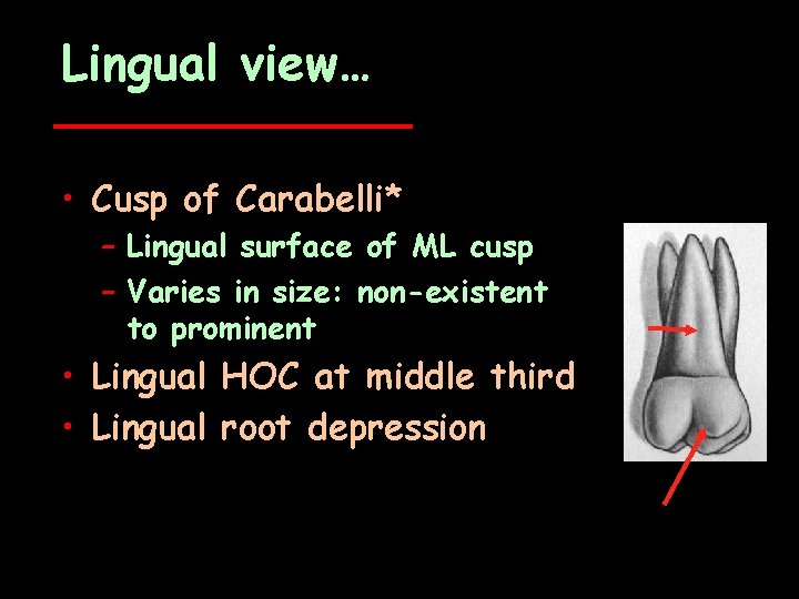 Lingual view… • Cusp of Carabelli* – Lingual surface of ML cusp – Varies