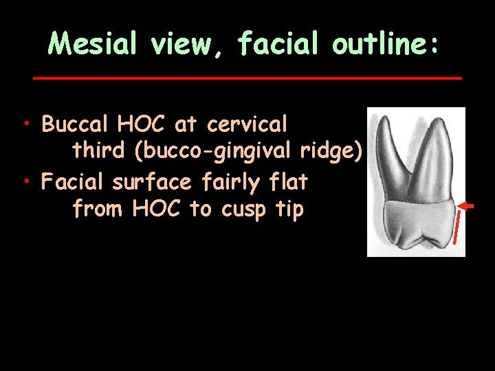 Mesial view, facial outline: • Buccal HOC at cervical third (bucco-gingival ridge) • Facial