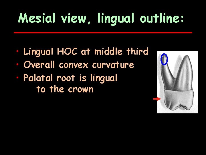 Mesial view, lingual outline: • Lingual HOC at middle third • Overall convex curvature