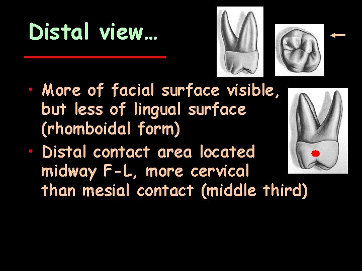 Distal view… • More of facial surface visible, but less of lingual surface (rhomboidal