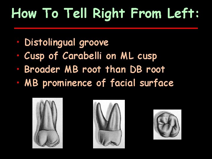 How To Tell Right From Left: • • Distolingual groove Cusp of Carabelli on