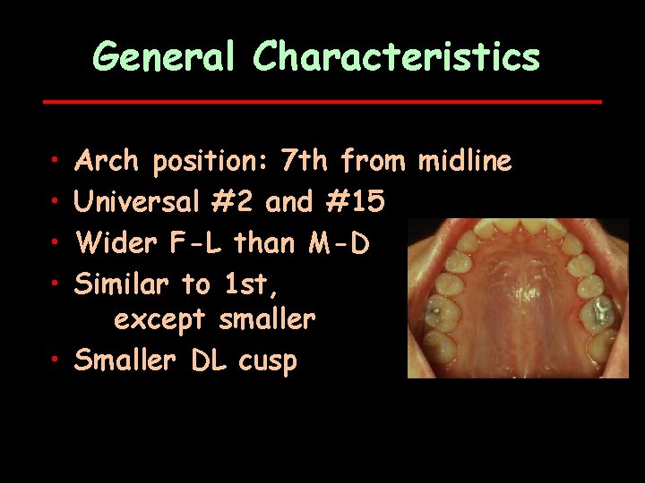 General Characteristics • • Arch position: 7 th from midline Universal #2 and #15