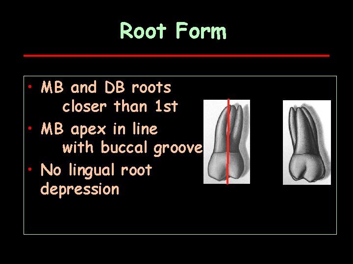 Root Form • MB and DB roots closer than 1 st • MB apex