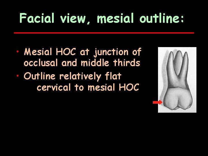 Facial view, mesial outline: • Mesial HOC at junction of occlusal and middle thirds