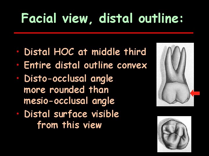 Facial view, distal outline: • Distal HOC at middle third • Entire distal outline