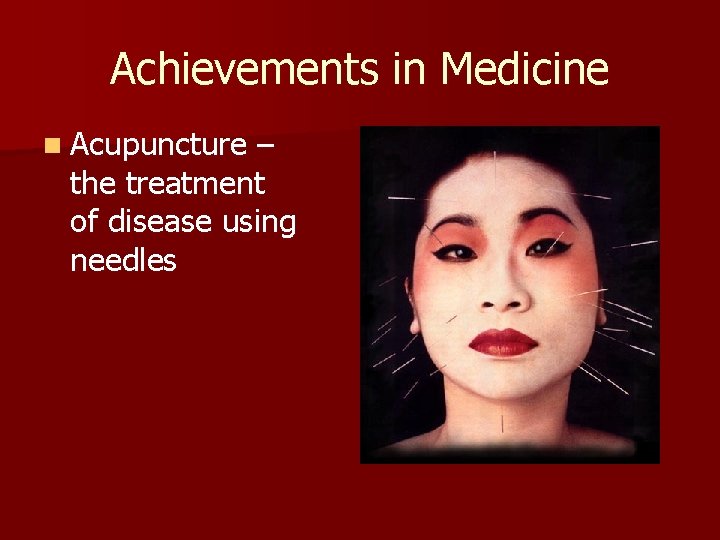 Achievements in Medicine n Acupuncture – the treatment of disease using needles 