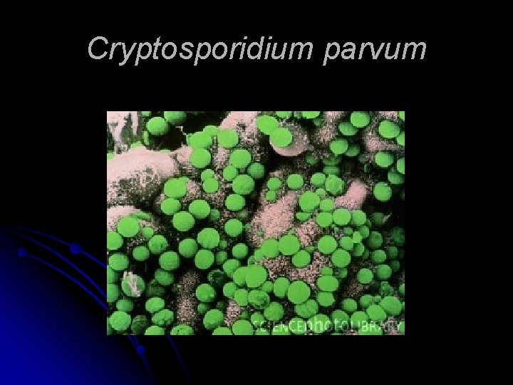 Cryptosporidium parvum 