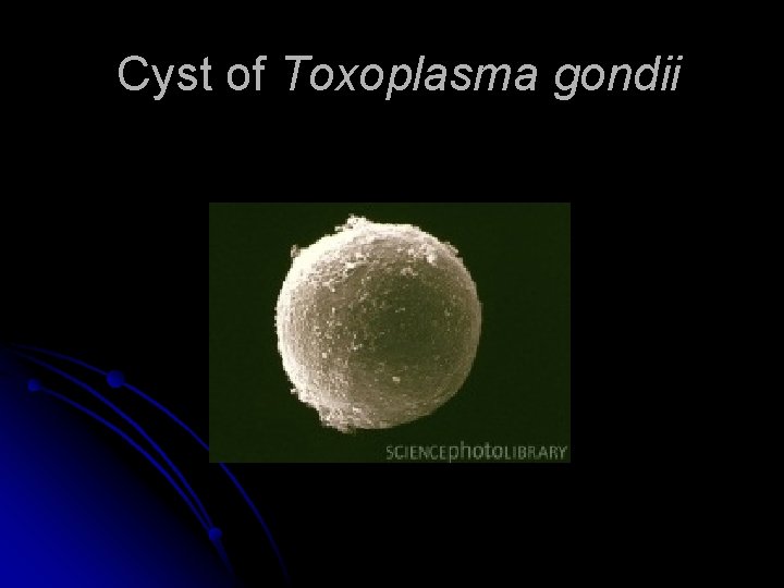 Cyst of Toxoplasma gondii 