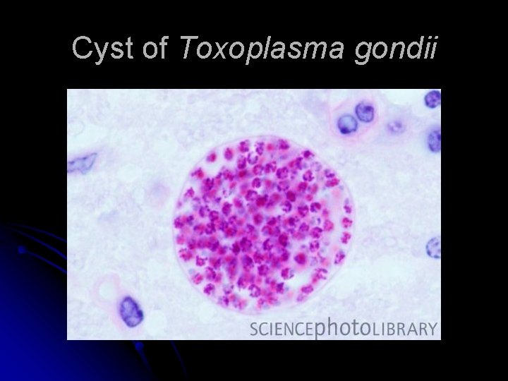 Cyst of Toxoplasma gondii 