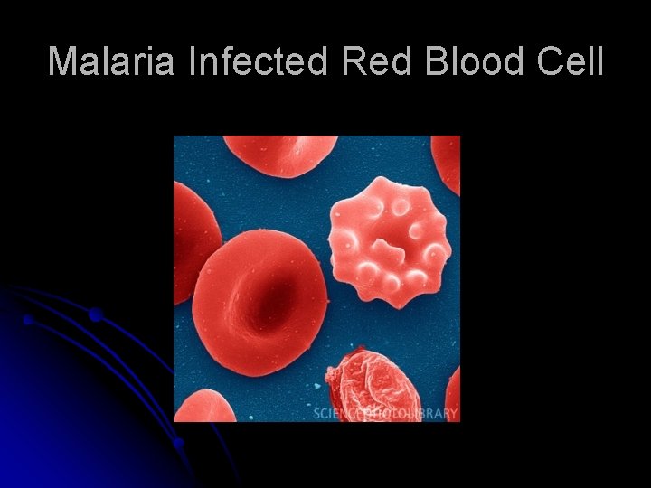 Malaria Infected Red Blood Cell 