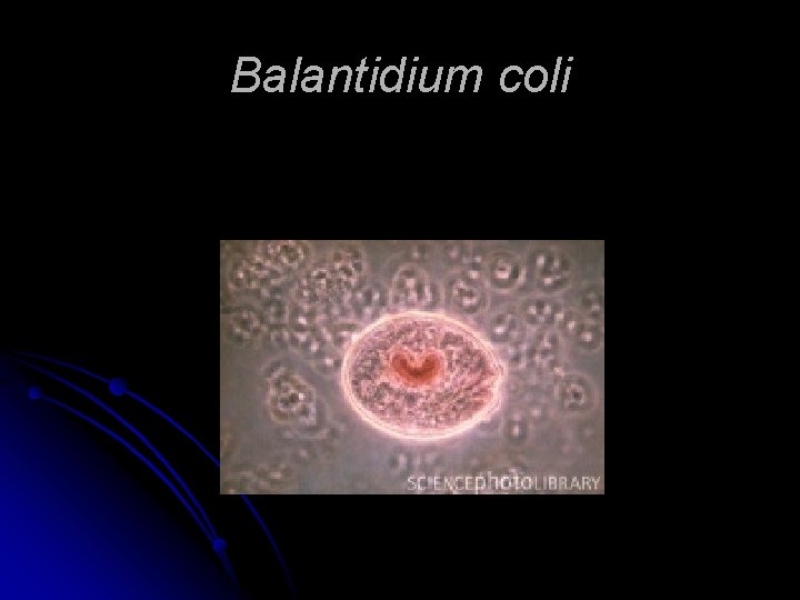 Balantidium coli 