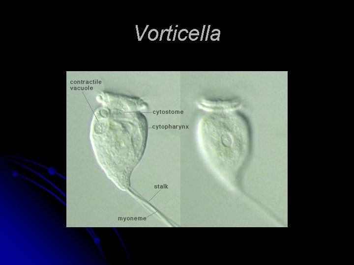 Vorticella 