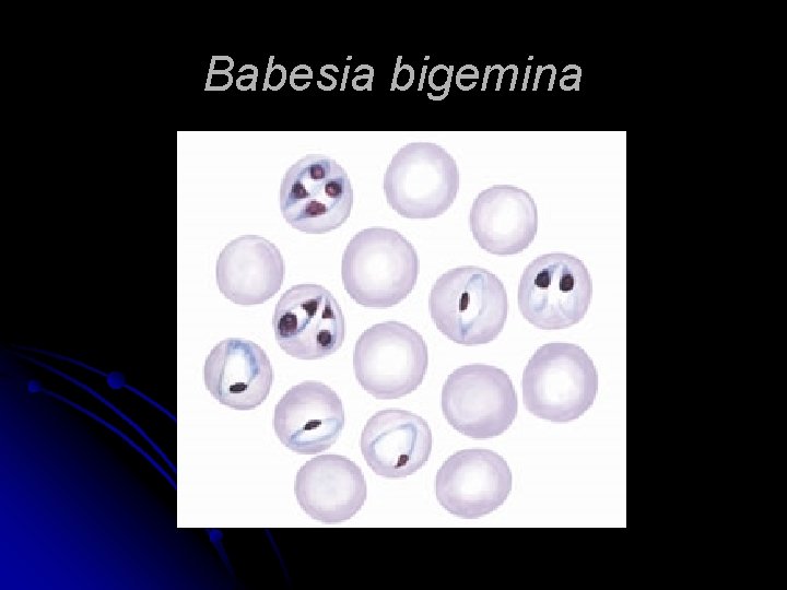 Babesia bigemina 