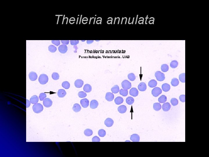 Theileria annulata 