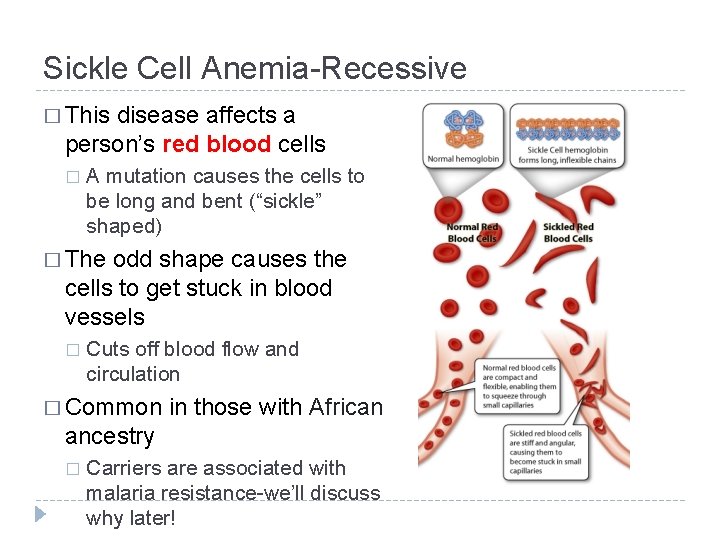 Sickle Cell Anemia-Recessive � This disease affects a person’s red blood cells � A