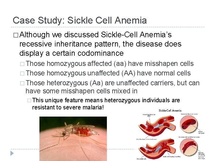 Case Study: Sickle Cell Anemia � Although we discussed Sickle-Cell Anemia’s recessive inheritance pattern,
