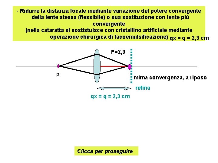 - Ridurre la distanza focale mediante variazione del potere convergente della lente stessa (flessibile)