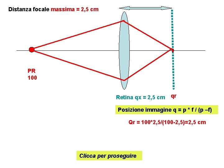 Distanza focale massima = 2, 5 cm PR 100 Retina qx = 2, 5