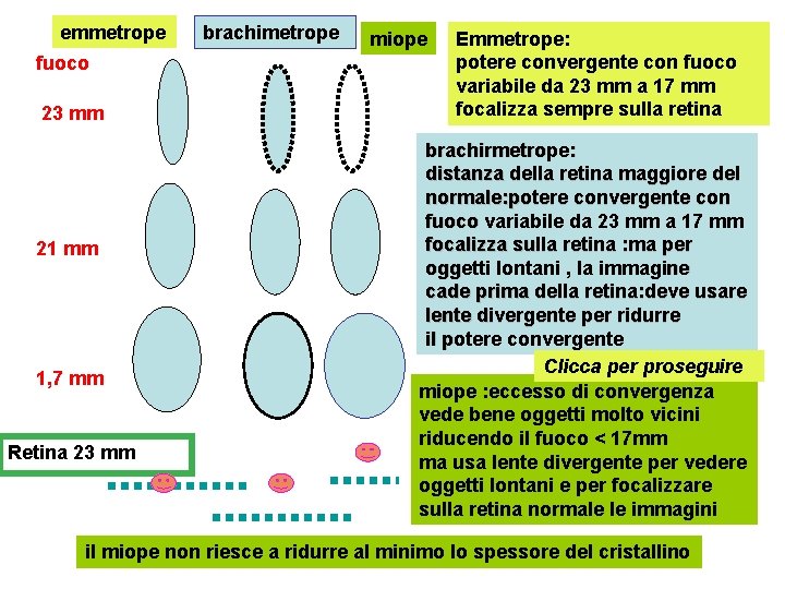 emmetrope fuoco 23 mm 21 mm 1, 7 mm Retina 23 mm brachimetrope miope