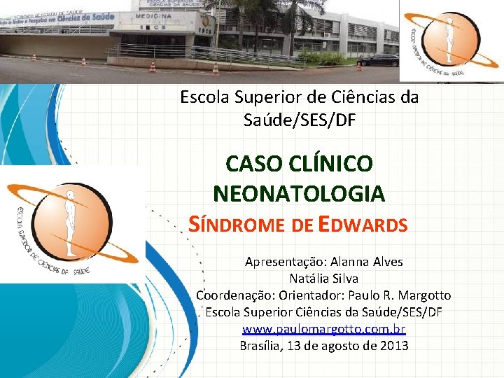 Escola Superior de Ciências da Saúde/SES/DF CASO CLÍNICO NEONATOLOGIA SÍNDROME DE EDWARDS Apresentação: Alanna