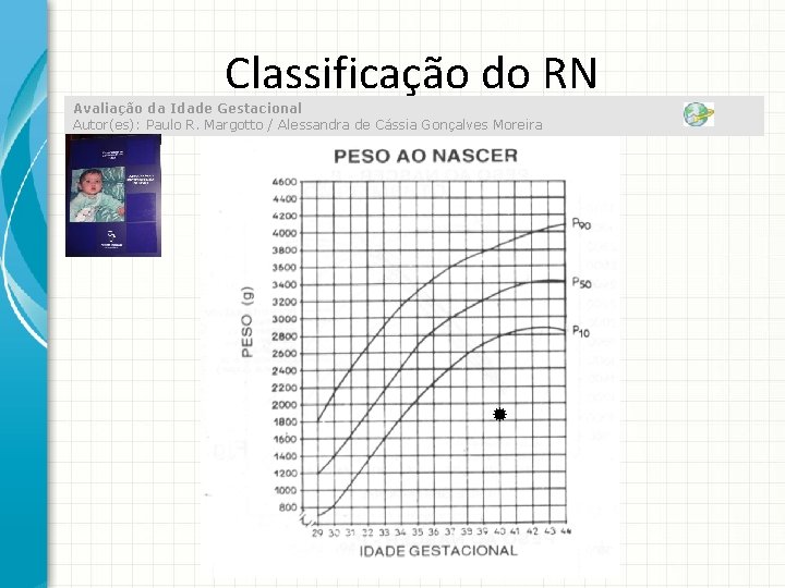 Classificação do RN Avaliação da Idade Gestacional Autor(es): Paulo R. Margotto / Alessandra de