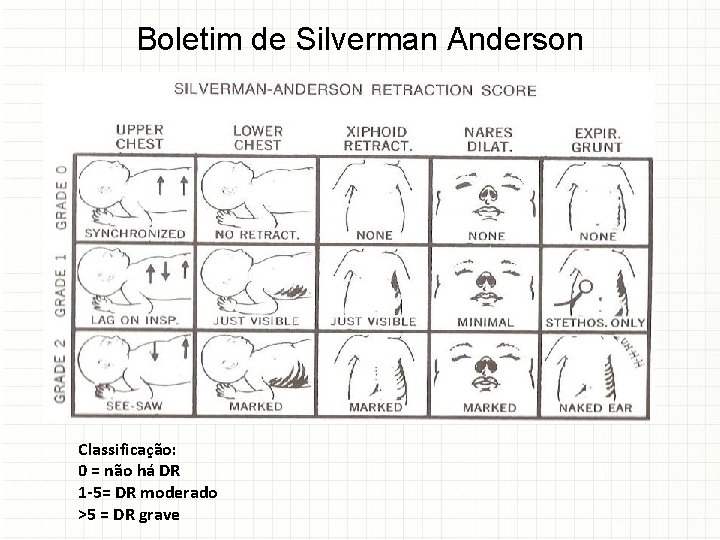 Boletim de Silverman Anderson Classificação: 0 = não há DR 1 -5= DR moderado