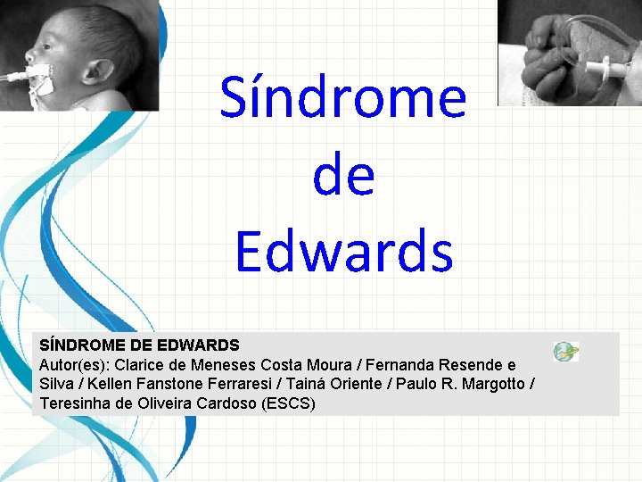 Síndrome de Edwards SÍNDROME DE EDWARDS Autor(es): Clarice de Meneses Costa Moura / Fernanda