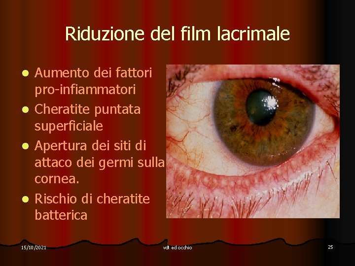 Riduzione del film lacrimale l l Aumento dei fattori pro-infiammatori Cheratite puntata superficiale Apertura