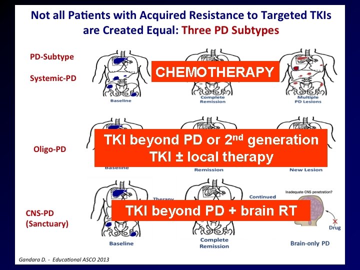 CHEMOTHERAPY TKI beyond PD or 2 nd generation TKI ± local therapy TKI beyond