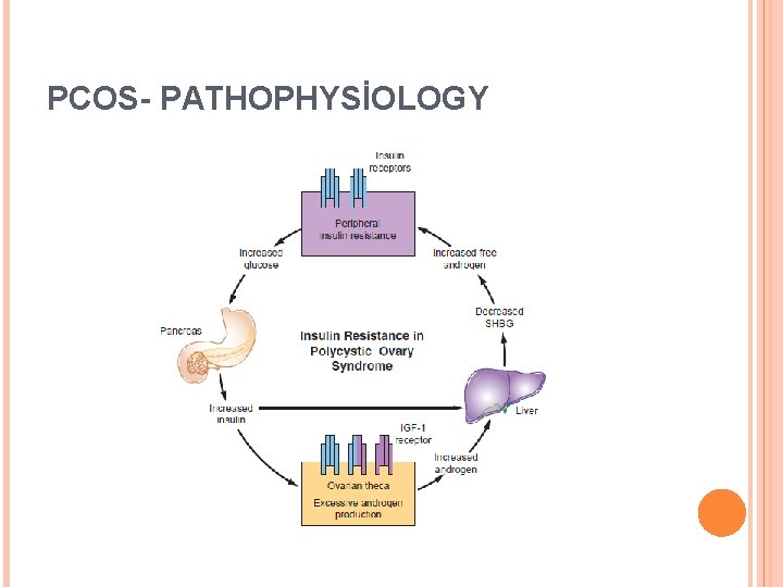 PCOS- PATHOPHYSİOLOGY 