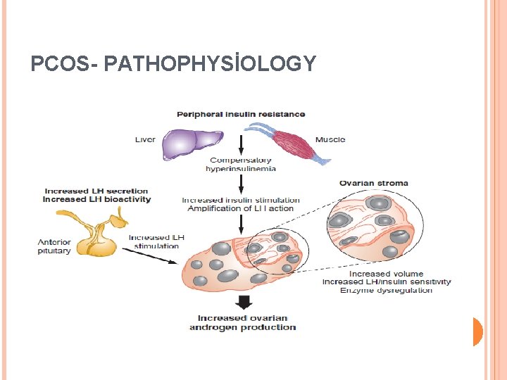 PCOS- PATHOPHYSİOLOGY 